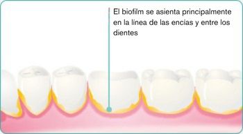 MX-explore-image-oral-care-vap-facts-2