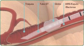 MX-explore-image-oral-care-vap-facts-3